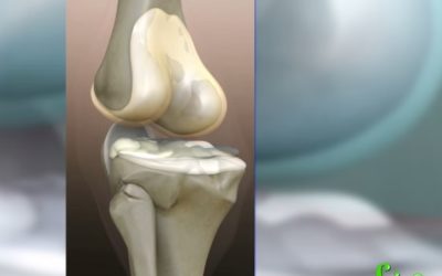 Why Do Joints Pop And Crack?