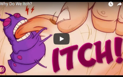 Why Do We Itch?