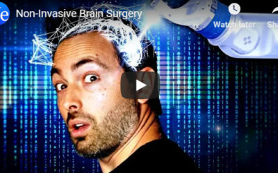 Non-Invasive Brain Surgery