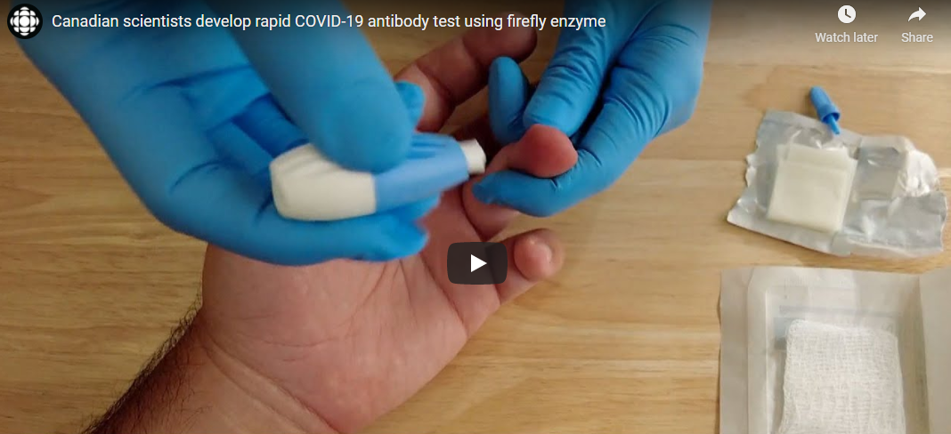 Canadian scientists develop rapid COVID-19 antibody test using firefly enzyme – CBC News, submitted by Kris Lee